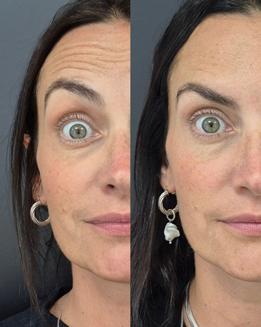 Antes e Depois Estetica no Morumbi2