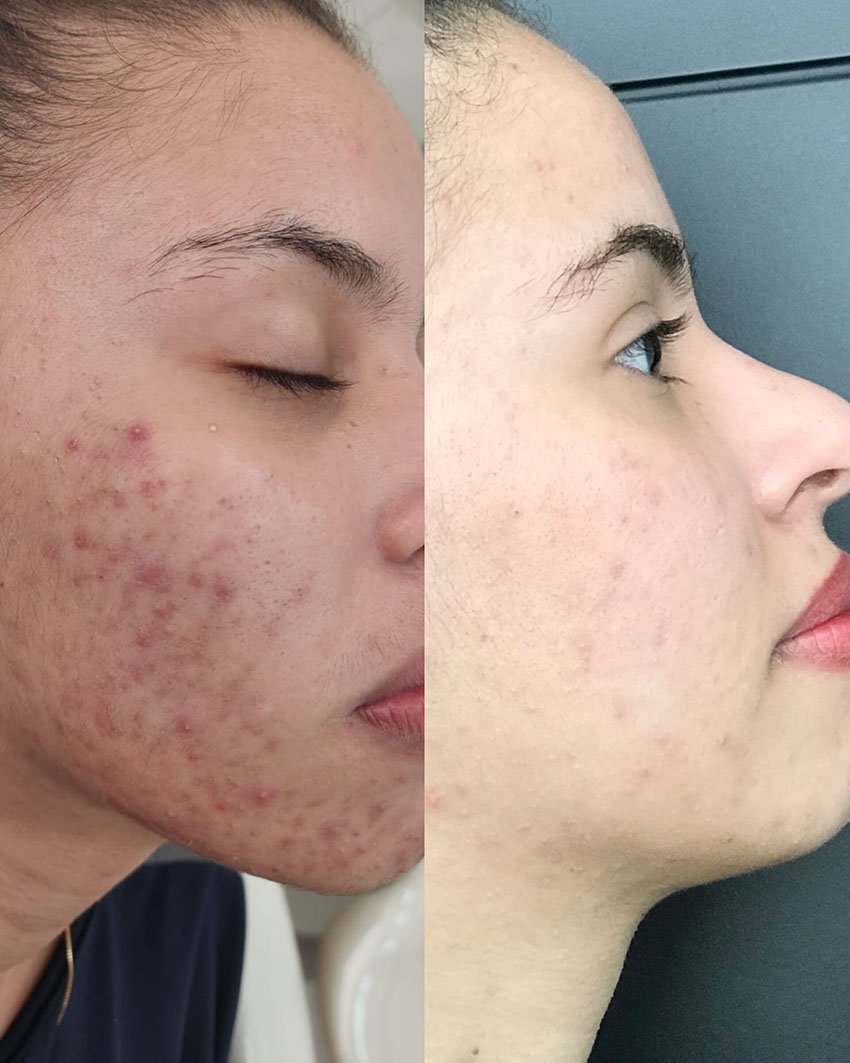Antes e Depois Estetica no Morumbi8